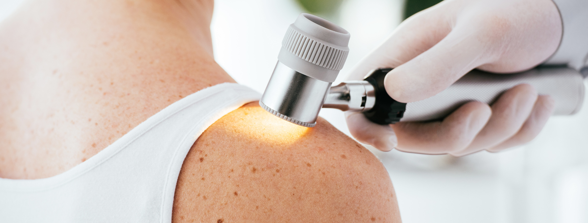 Mire számíts, ha anyajegyszűrésre mész?